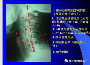 脊椎病的x光片解析集合