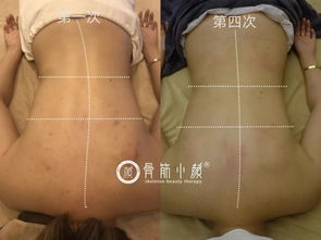脊椎不好百病生 含胸驼背的你和健康脊椎只差一个日式整骨小颜