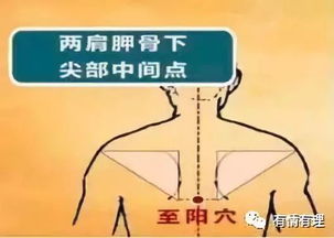 颈肩腰腿穴位膏药贴敷指导详解